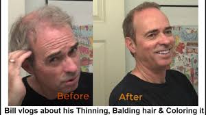 Allow your medium length hair and ducktail beard to combine into a marvelous look. Bill Vlogs About His Thinning Balding Hair His Cut Color Style Men Over 50 Youtube