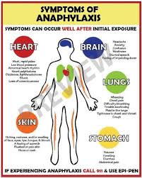 Allergy Emergency Anaphylaxis Symptoms Poster School