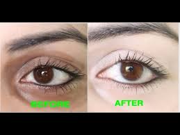 how to remove dark circles naturally in
