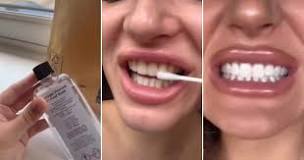 does-swishing-hydrogen-peroxide-whiten-teeth
