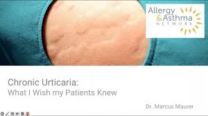 what is chronic urticaria allergy