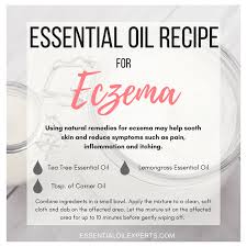 treating eczema naturally