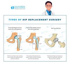 what can cause hip pain in women