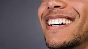 how does teeth whitening work alex