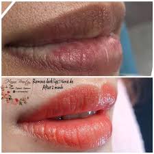 remove dark lips beauty personal