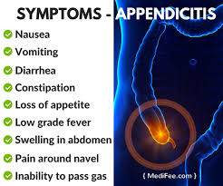 Image result for symptoms of appendicitis