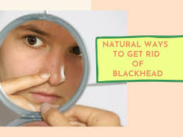 blackhead removal tips 6 natural ways