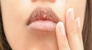 4 reasons why you have chapped lips