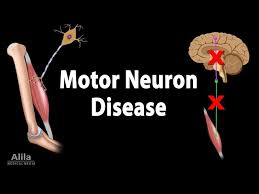 motor neuron disease animation you