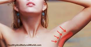 how to get rid of armpit rash natural