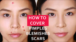 cover spots acne blemishes scars