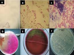 staphylococcus spp