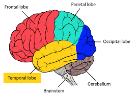 Temporal lobe seizure