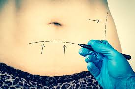 how much is a tummy tuck cost in year