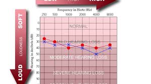 How To Read An Audiogram