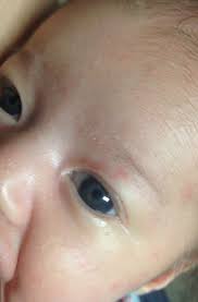 Baby Eye Color Question Babycenter