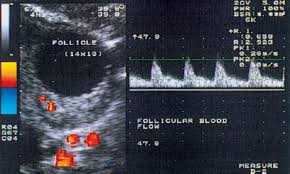 doppler ultrasound examinations from