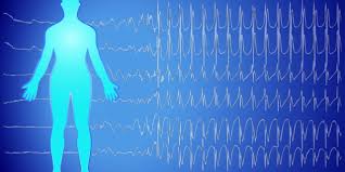 What Are Pemf Frequency Intensity Waveform Dr Pawluk