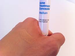 review murad acne treatment concealer