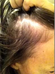 Cbd oil can also be used to treat an itchy scalp. Pin On Hair