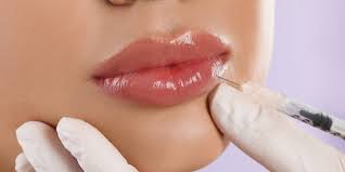 best lip filler in alexandria virginia