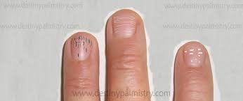 fingernail ridges and the meaning of