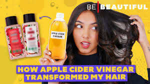 apple cider vinegar shoo benefits