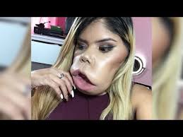 this beauty vlogger with a face tumor