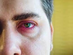 sore eyelid causes when to see a