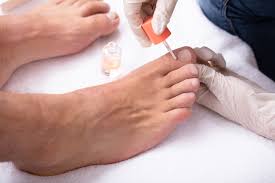 top treatments for toenail fungus