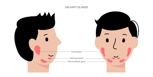 salivary gland disorders causes