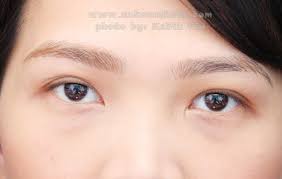 double eyelid glue and tape type