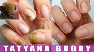 restoring nails from bacteria