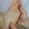 Feet case study