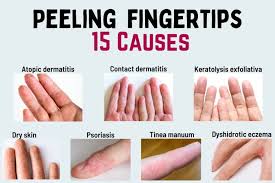 skin ling on fingertips 15 causes