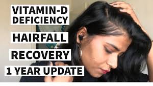 vitamin d deficiency recovery 1