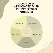 pelvic floor physical therapy helps
