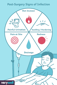 signs of infection after surgery