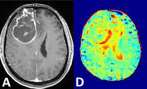 mri contrast agents aiming to work
