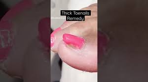 thick toenails remedy let me show you