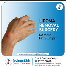 lipoma treatment dr jaee parvatkar