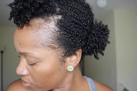 post partum shedding on natural hair