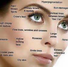 Wait _ everyone is here before you start the meeting. Pin By Nikki Davis On Beauty Crepey Skin Sun Damaged Skin Skin