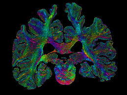 A unified 3D map of microscopic architecture and MRI of the human ...