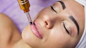 is microneedling your lips a safe
