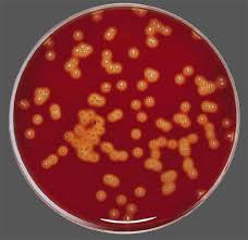 It is a mixture of agarose and. Columbia Cna Agar Bioser