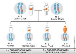 Sickle Cell Anemia And Pregnancy