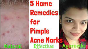 pimple marks scars removal at home