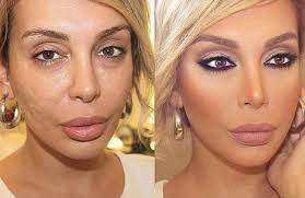 20 before after contour makeovers