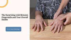 fingernails and your overall health